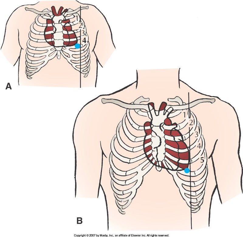 Apical pulse on infant vs. adult.jpg